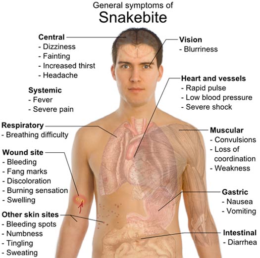 general symptoms of snakebite